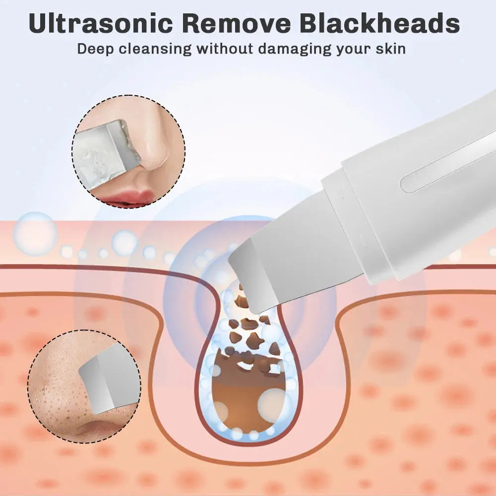 Skin Scrubber Ultrasonic Facial Machine for Home Use Spatula for Blackhead Remover Shovel Peeling Pore Cleaner Face Lift Massage - Nova Trendz