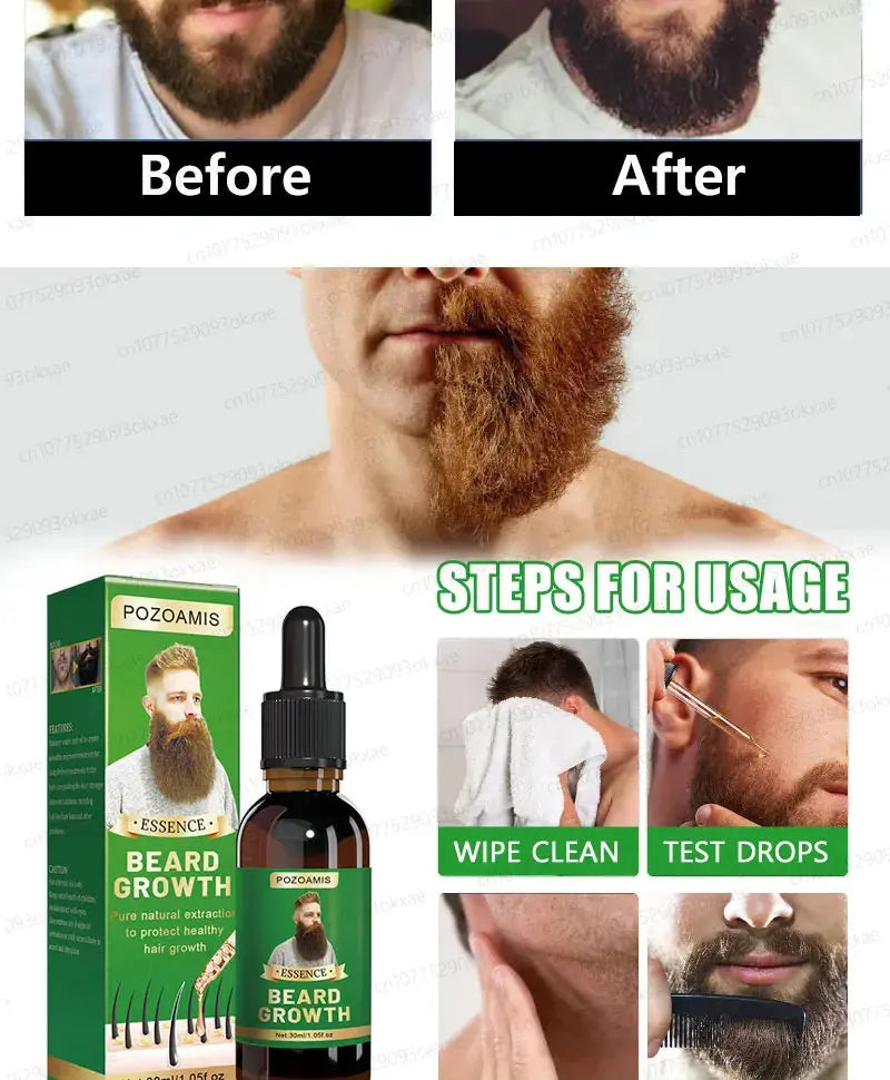The most effective beard growth essence in 2025, grow a thick beard in 7 days. Chest hair, leg hair, beard and hair growth Nova Trendz
