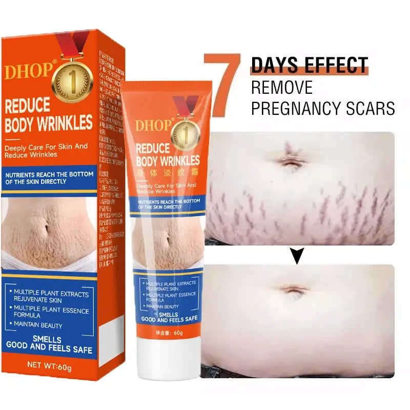 Stretch Marks Permanent Removal Cream Maternity Pregnant Women Pregnancy Anti-Winkle Smooth Repair Firming Skin Body Skin Care Nova Trendz