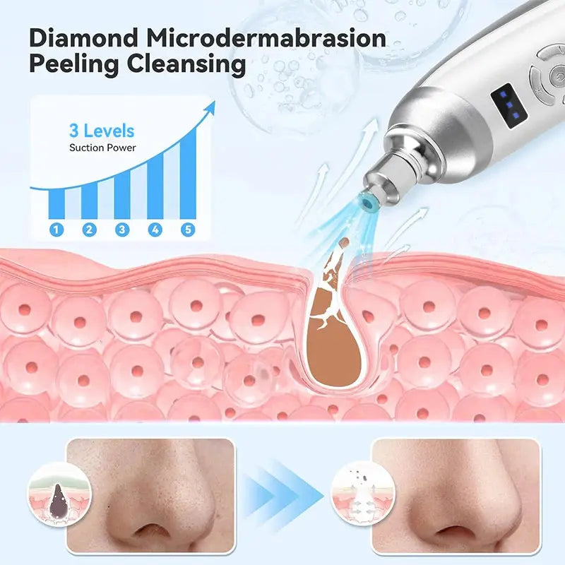 Handheld Diamond Microdermabrasion Machine Newest Facial Peeling Beauty Device Blackhead Removal Acne Clearning Skin Care Tool Nova Trendz
