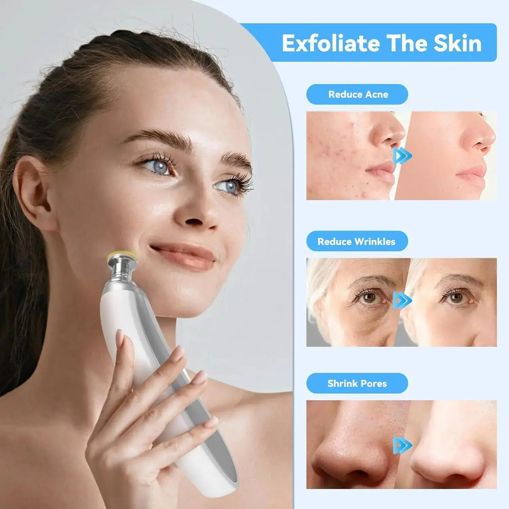 Handheld Diamond Microdermabrasion Machine Newest Facial Peeling Beauty Device Blackhead Removal Acne Clearning Skin Care Tool Nova Trendz