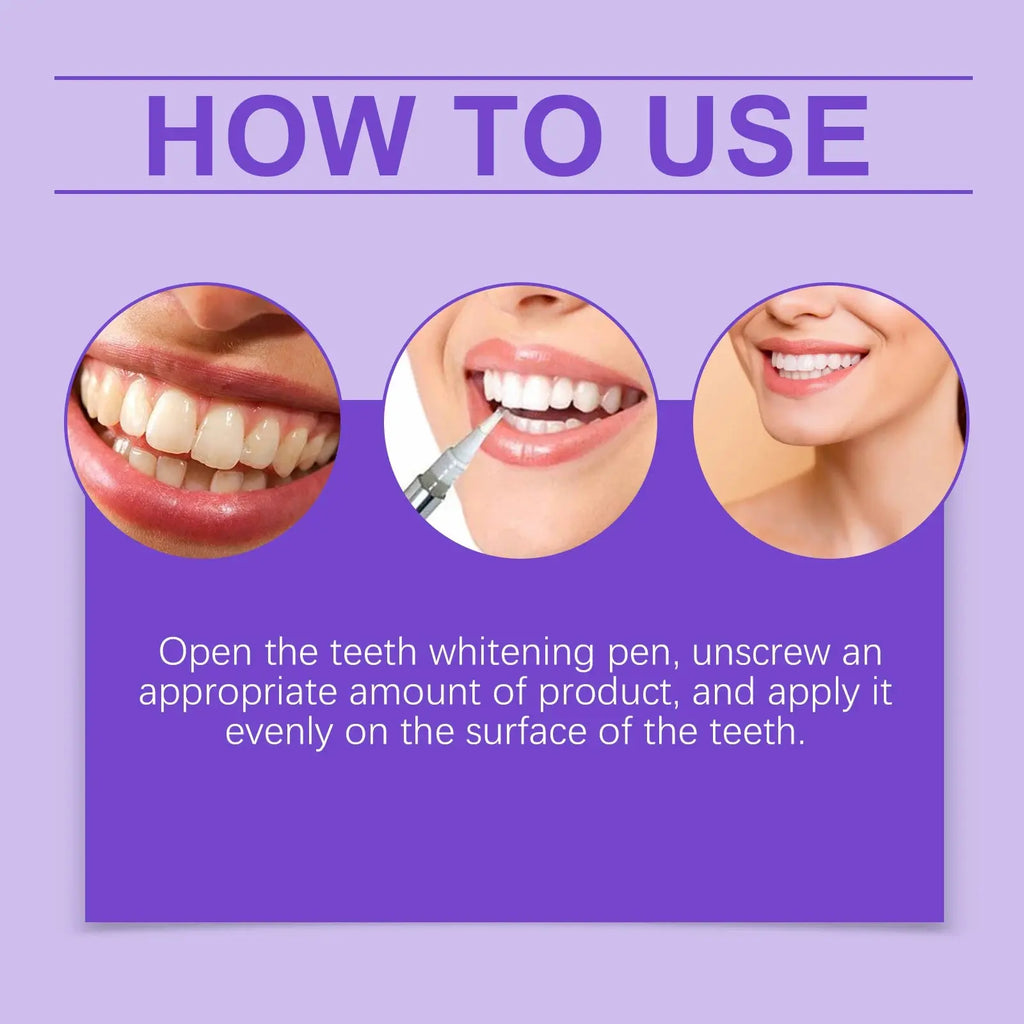 6ml Teeth Whitening Pen Teeth Gel Whitener Bleach Remove Stains Oral Hygiene Instant Smile Teeth Whitening Cleansing Serum - Nova Trendz
