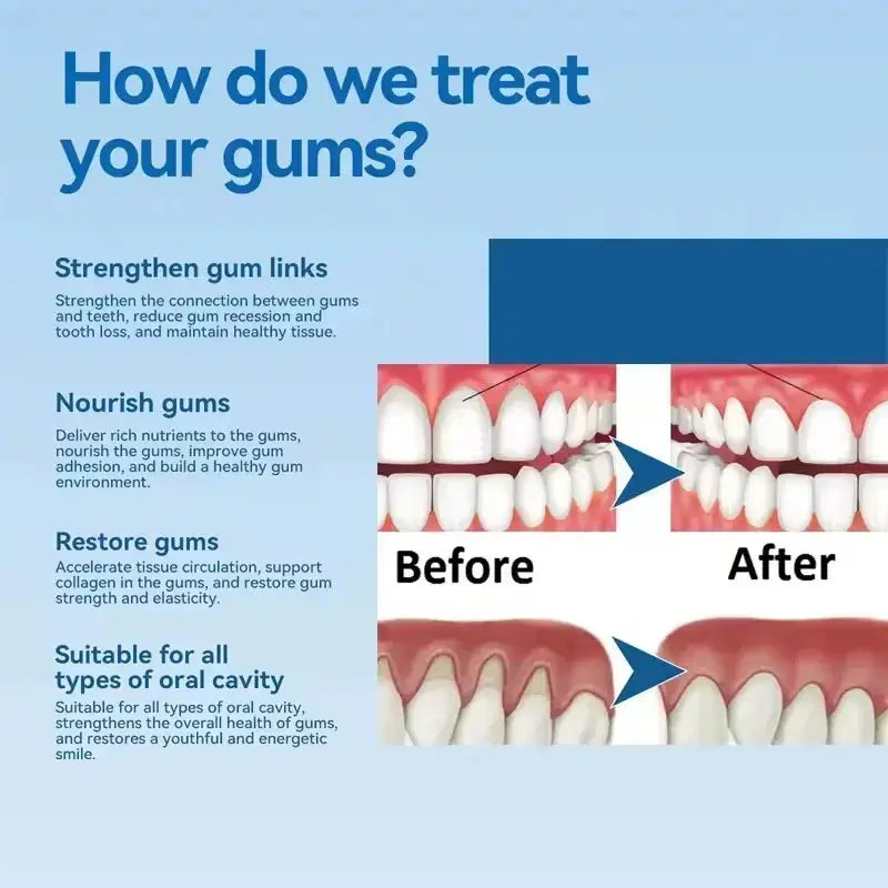 Damaged Gum Repair Care Gel Relieve Sore Gums Allergy Deep Cleaning Teeth Stains Tartar Serum Dental Caries Toothpaste - Nova Trendz
