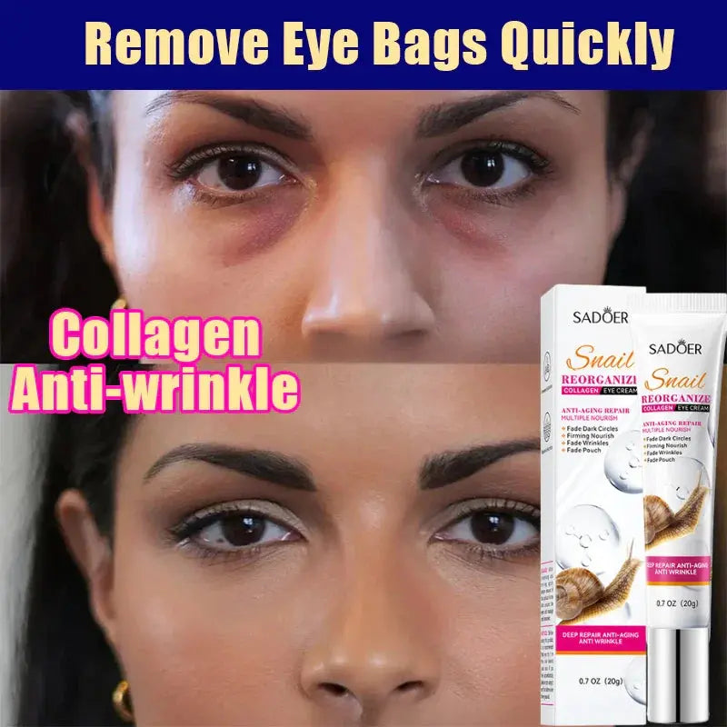 Remove Eyes Bags Eye CreamSnail Collagen Anti Dark Circles Anti-wrinkleMoisturizing Firming Beauty Eyes SkinCare Products Nova Trendz