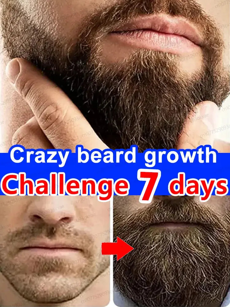 The most effective beard growth essence in 2025, grow a thick beard in 7 days. Chest hair, leg hair, beard and hair growth Nova Trendz