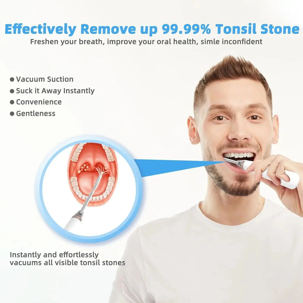 Electronic Vacuum Tonsil Stone Remover Kit with 5 Suction Modes 10in1 Tonsil Stone Cleaner Mouth Cleaning Tool Oral Fresh Care Nova Trendz