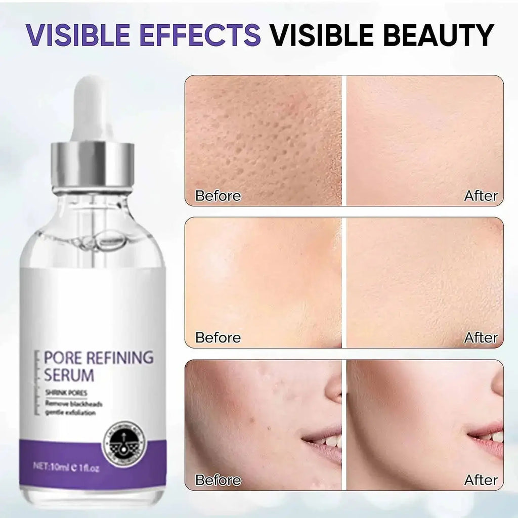 Pore Shrinking Serum Face Removing Large Pores Tightening Repairing Facial Pore Minimizing Essence Skin Care Beauty Firm skin Nova Trendz
