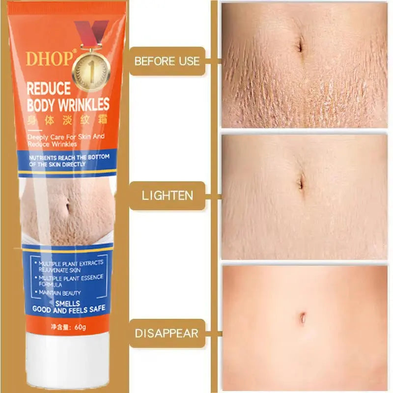 Stretch Marks Permanent Removal Cream Maternity Pregnant Women Pregnancy Anti-Winkle Smooth Repair Firming Skin Body Skin Care Nova Trendz