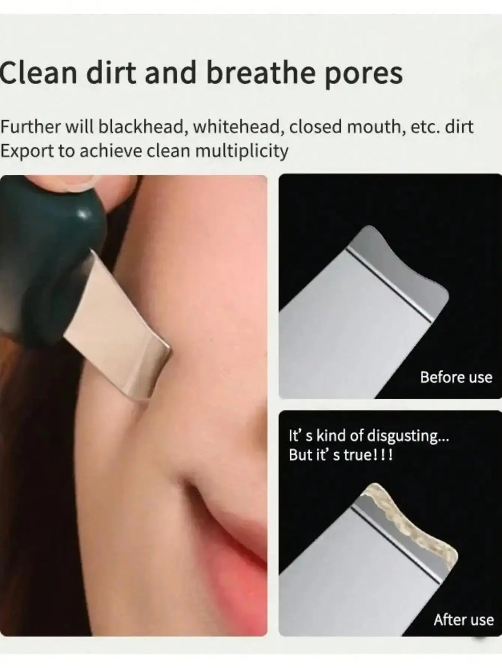 Facial Skin Scrubber Face Spatula Exfoliator Deep Cleansing Tool Blackhead Remover Pore Cleaner Body Skin Spatula Skin Care Tool Nova Trendz