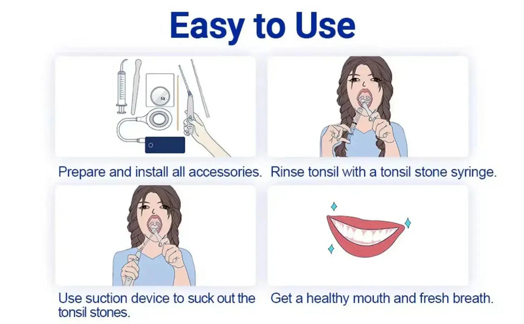Electronic Vacuum Tonsil Stone Remover Kit with 5 Suction Modes 10in1 Tonsil Stone Cleaner Mouth Cleaning Tool Oral Fresh Care Nova Trendz