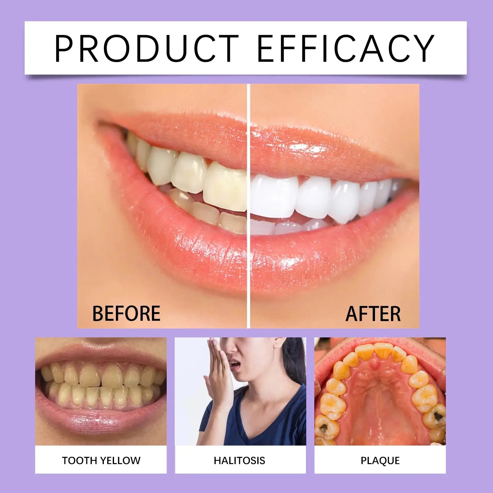 6ml Teeth Whitening Pen Teeth Gel Whitener Bleach Remove Stains Oral Hygiene Instant Smile Teeth Whitening Cleansing Serum - Nova Trendz